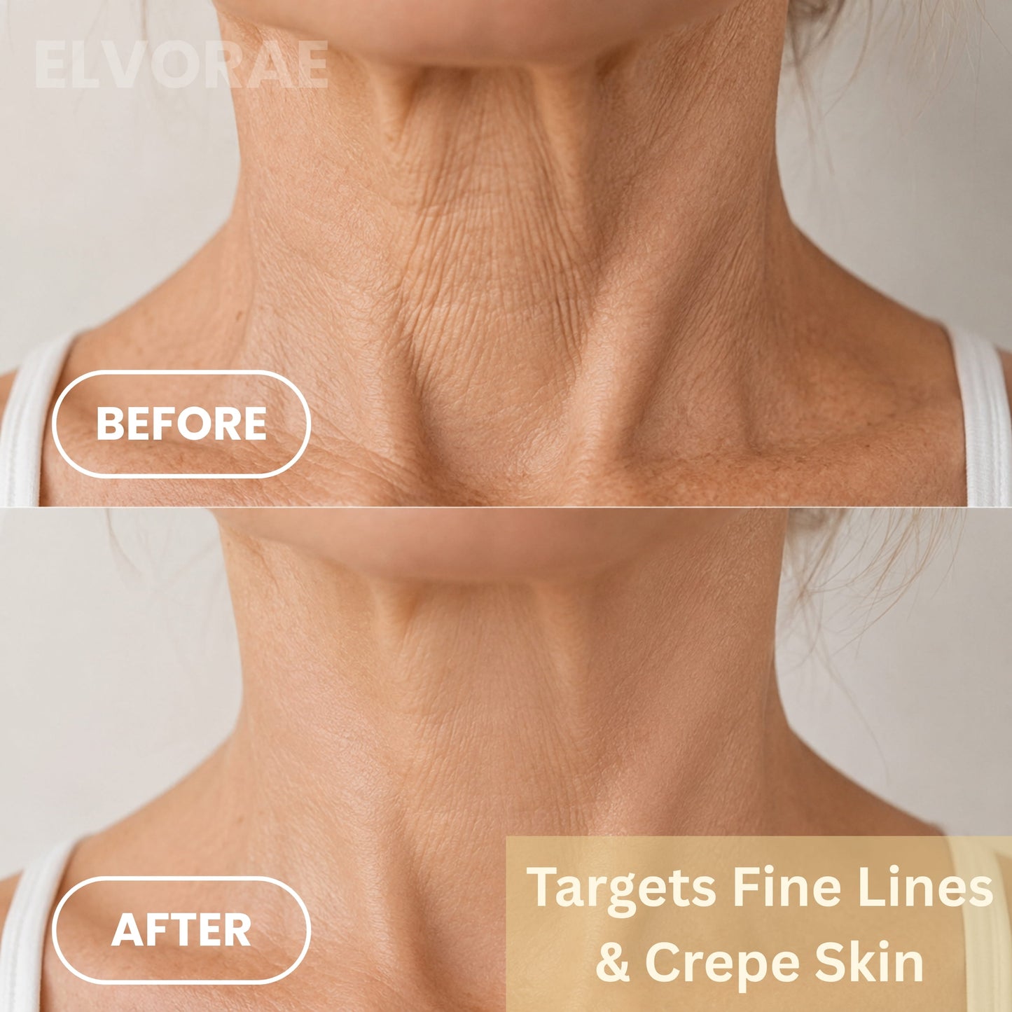 Elvorae Retinal Stick