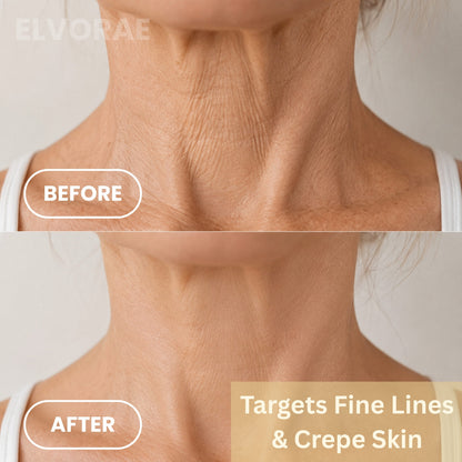 Elvorae Retinal Stick